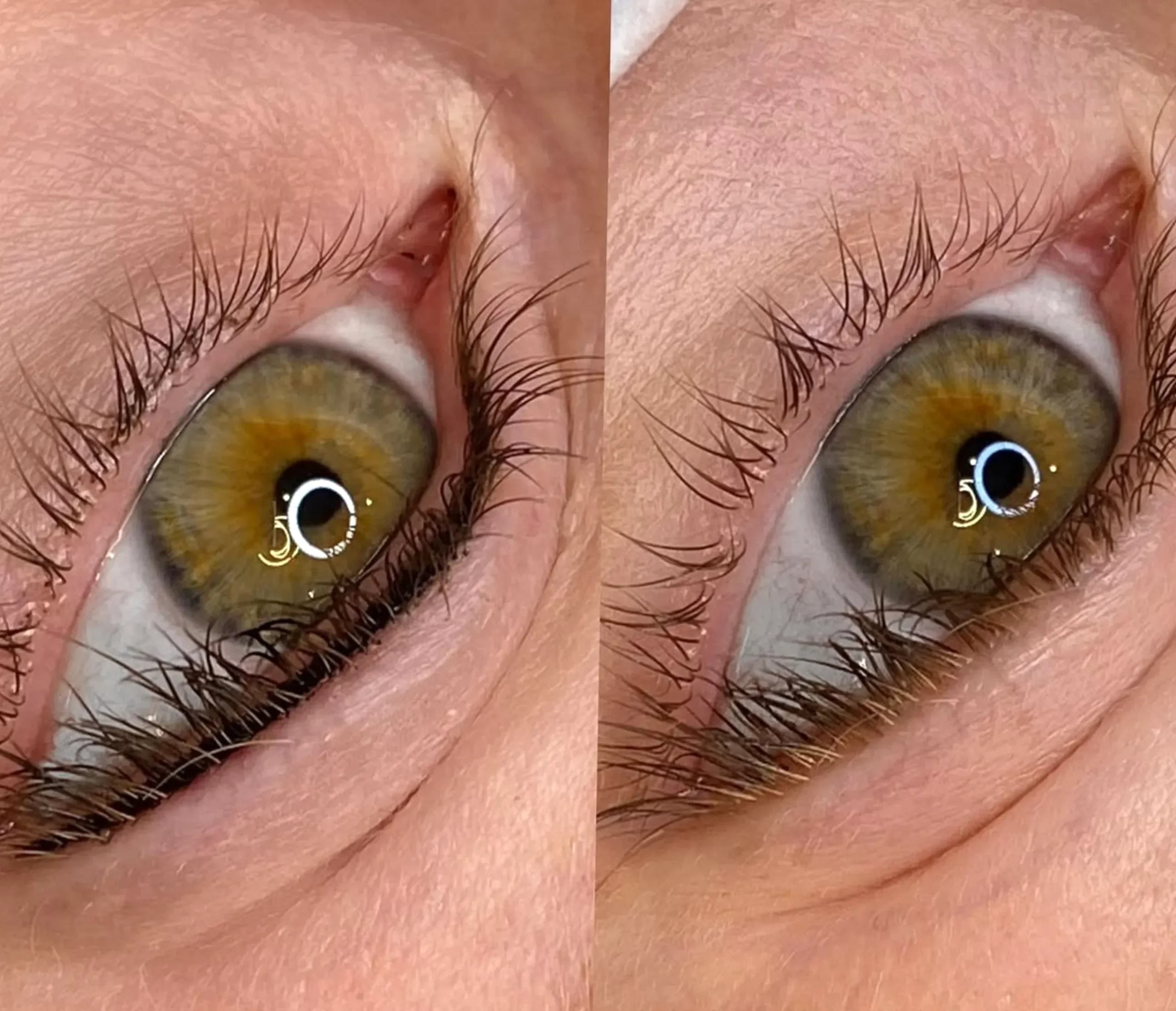conjunctival tattoo vs eyeliner tattoo